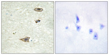 GRK 1 antibody