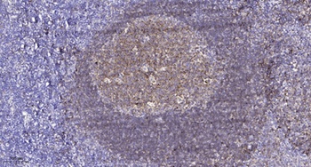 GRK 3 rabbit pAb