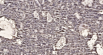 GRK 5 antibody