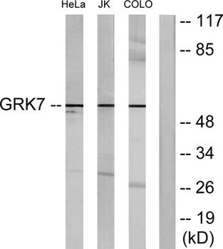 GRK 7 rabbit pAb Antibody