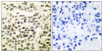 GSK3α/β rabbit pAb