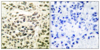 GSK3alpha/beta antibody