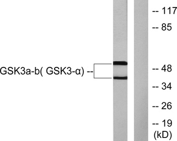 GSK3alpha/beta antibody