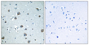 G alpha olf antibody