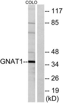 G alpha t1 antibody