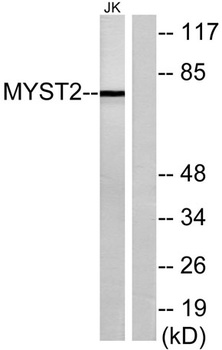 HBO1 antibody