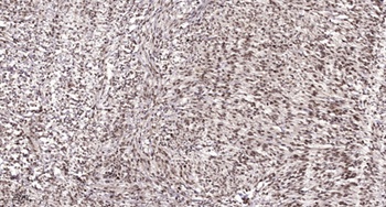 HBP1 rabbit pAb