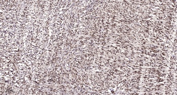 HBP1 antibody