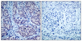 HDAC2 rabbit pAb