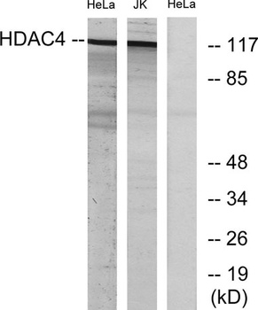 HDAC4 rabbit pAb