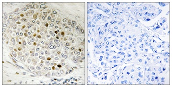 HDAC5 rabbit pAb
