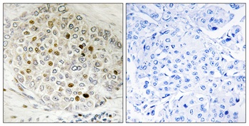 HDAC5 antibody