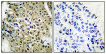 HDAC5/9 antibody