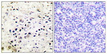 HDAC5/9 rabbit pAb