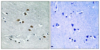 HDAC6 rabbit pAb