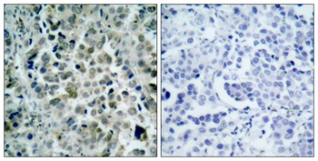 HDAC8 rabbit pAb