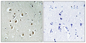 HEI10 antibody