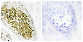 HIPK4 antibody