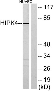 HIPK4 antibody