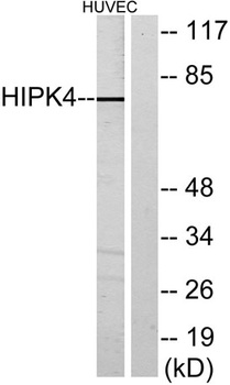 HIPK4 rabbit pAb
