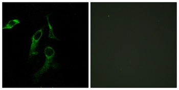 HisRS antibody