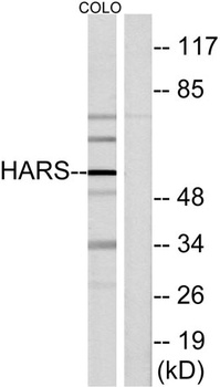 HisRS antibody