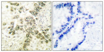 Histone deacetylase 1 rabbit pAb