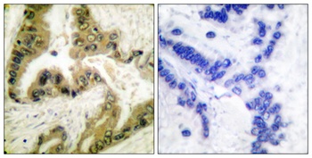 Histone deacetylase 10 antibody