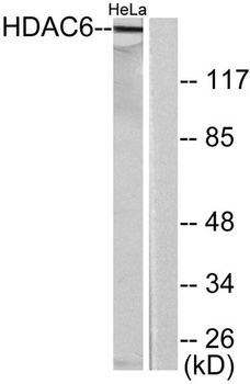 Histone deacetylase 6 antibody