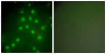 Histone deacetylase 9 antibody