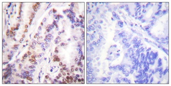 Histone deacetylase 9 antibody