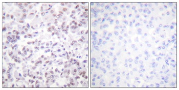 Histone H2B antibody