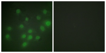 HKR1 rabbit pAb