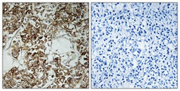 HLA-DOalpha antibody