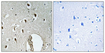 HLX1 antibody