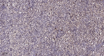 HNF-4α rabbit pAb