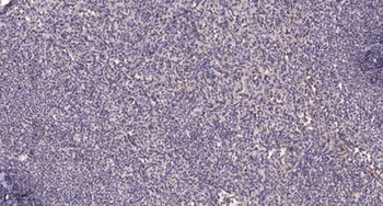 HNF-4 alpha/gamma antibody