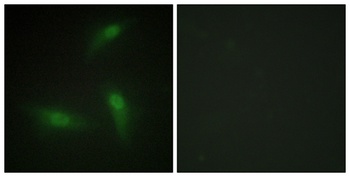 hnRNP A1 antibody