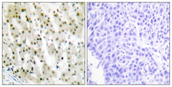 hnRNP A1 antibody