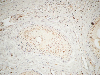 hnRNP A2/B1 rabbit pAb