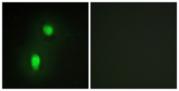 hnRNP C1/C2 rabbit pAb