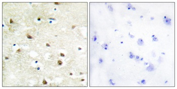 hnRNP C1/C2 rabbit pAb