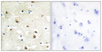 hnRNP C1/C2 antibody