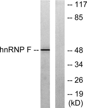 hnRNP F antibody