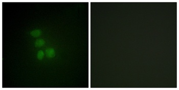 hnRNP G antibody