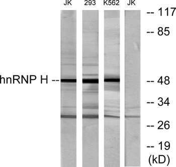 hnRNP H antibody