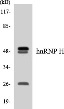 hnRNP H antibody