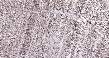 hnRNP H antibody