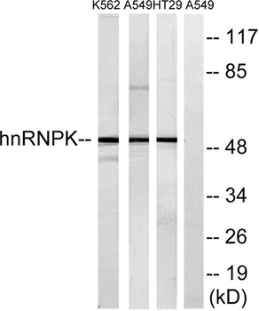 hnRNP K antibody