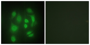 hnRNP Q antibody